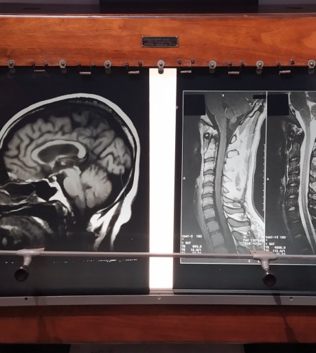 O-0170 Negatoscoop De Man + MRI
